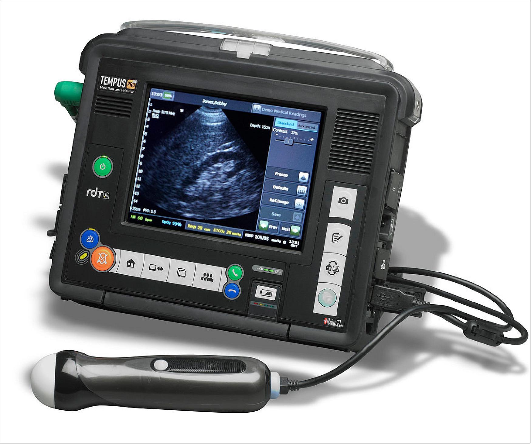 Figure 7: Ultrasound patient monitoring using Tempus Pro (photo credit: ESA) 5)