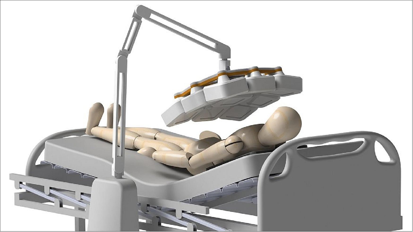 Figure 59: Concept system of a 3D mobile X-ray machine (image credit: Adaptix Imaging)